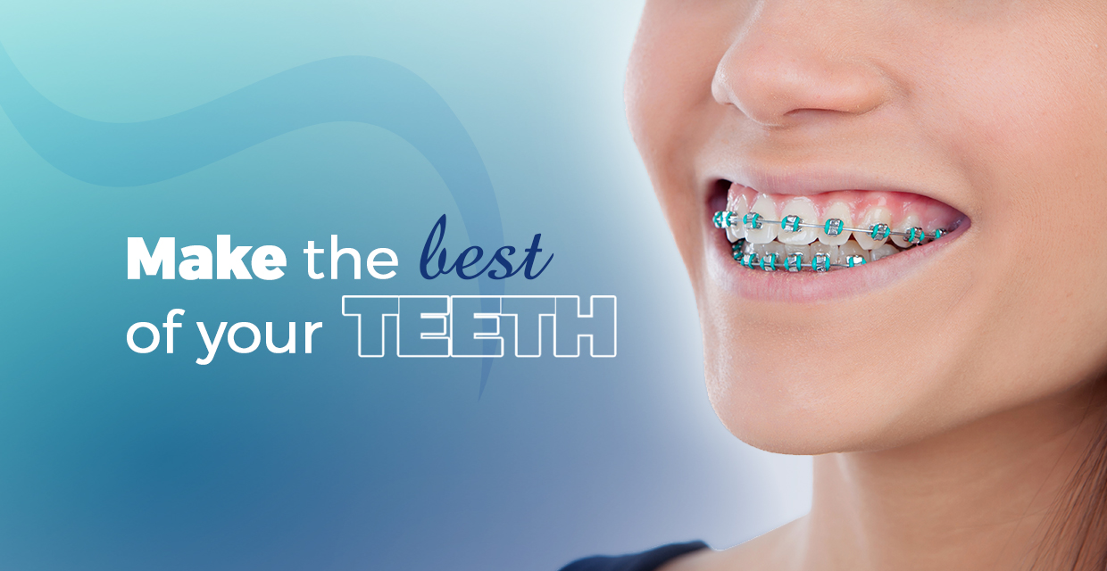 The best of your teeth